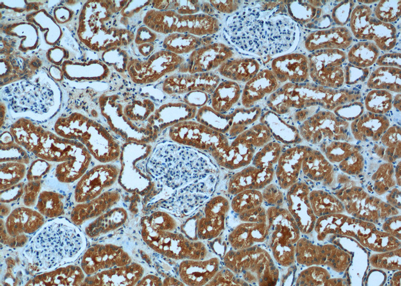 Immunohistochemistry of paraffin-embedded human kidney tissue slide using Catalog No:116685(USP46 Antibody) at dilution of 1:50 (under 10x lens)