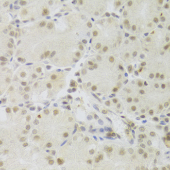 Immunohistochemistry - PRPF3 Polyclonal Antibody 