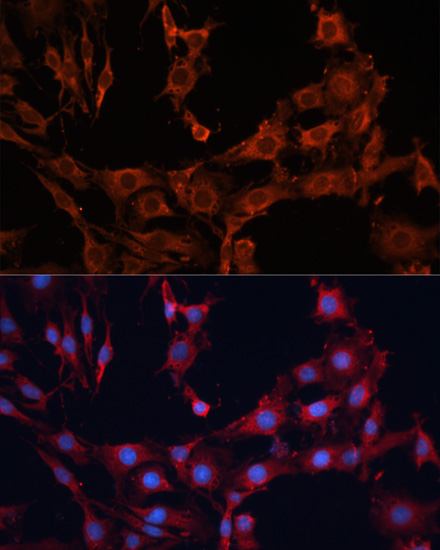 Immunofluorescence - SLC25A27 Polyclonal Antibody 