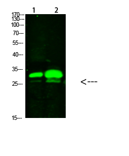 Fig1:; Western Blot analysis of 1,mouse-brain 2,mouse-spleen cells using primary antibody diluted at 1:1000(4°C overnight). Secondary antibody: Goat Anti-rabbit IgG IRDye 800( diluted at 1:5000, 25°C, 1 hour)