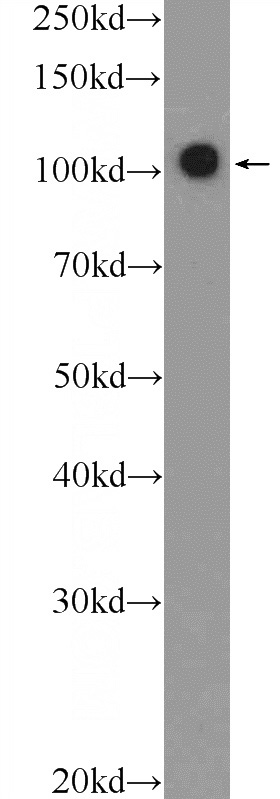 Jurkat cells were subjected to SDS PAGE followed by western blot with Catalog No:114488(RB1 Antibody) at dilution of 1:300