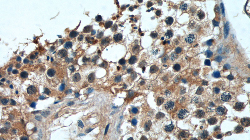 Immunohistochemistry of paraffin-embedded human testis tissue slide using Catalog No:116848(WBP2NL Antibody) at dilution of 1:50 (under 40x lens)