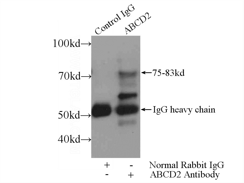 IP Result of anti-ABCD2 (IP:Catalog No:107803, 4ug; Detection:Catalog No:107803 1:300) with A431 cells lysate 1200ug.