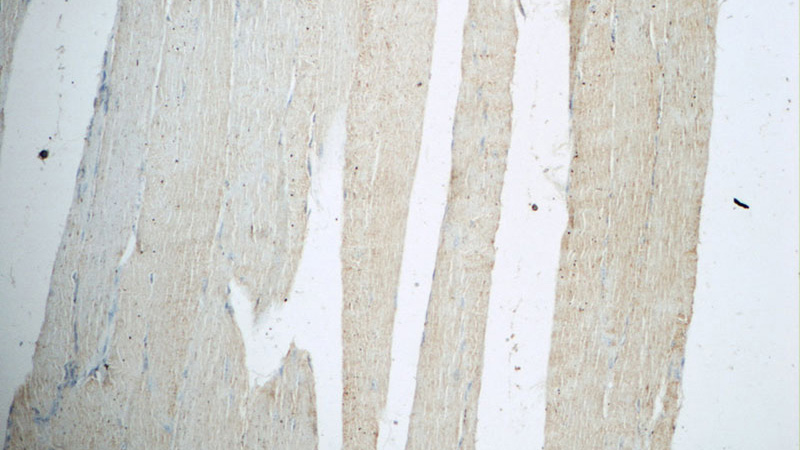 Immunohistochemistry of paraffin-embedded human skeletal muscle tissue slide using Catalog No:113391(NT5C Antibody) at dilution of 1:50 (under 10x lens)