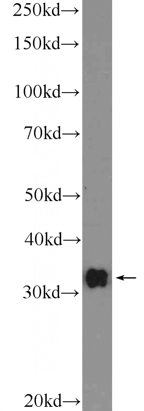 mouse brain tissue were subjected to SDS PAGE followed by western blot with Catalog No:109347(CLEC12B Antibody) at dilution of 1:1000