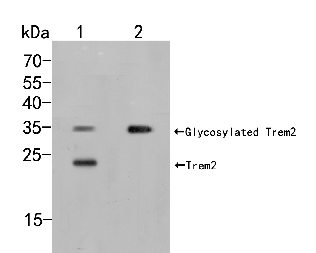 Fig1:; Western blot analysis of Trem2 on different lysates. Proteins were transferred to a PVDF membrane and blocked with 5% BSA in PBS for 1 hour at room temperature. The primary antibody ( 1/500) was used in 5% BSA at room temperature for 2 hours. Goat Anti-Rabbit IgG - HRP Secondary Antibody (HA1001) at 1:5,000 dilution was used for 1 hour at room temperature.; Positive control:; Lane 1: THP-1 cell lysate; Lane 2: Rat bone marrow tissue lysate