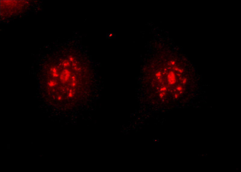 Immunofluorescent analysis of HeLa cells using Catalog No:110002(DMC1 Antibody) at dilution of 1:50 and Rhodamine-Goat anti-Rabbit IgG