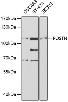 Western blot - POSTN Polyclonal Antibody 