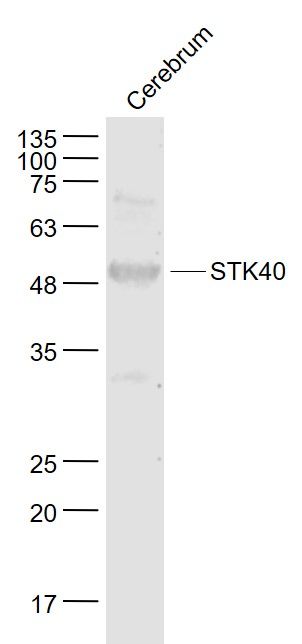 Fig3: Sample:; Cerebrum (Mouse) Lysate at 40 ug; Primary: Anti- STK40 at 1/1000 dilution; Secondary: IRDye800CW Goat Anti-Rabbit IgG at 1/20000 dilution; Predicted band size: 48 kD; Observed band size: 49 kD