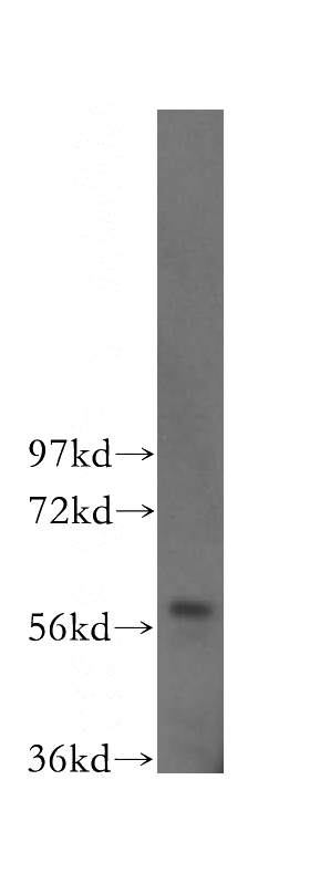 HeLa cells were subjected to SDS PAGE followed by western blot with Catalog No:116166(TOE1 antibody) at dilution of 1:500