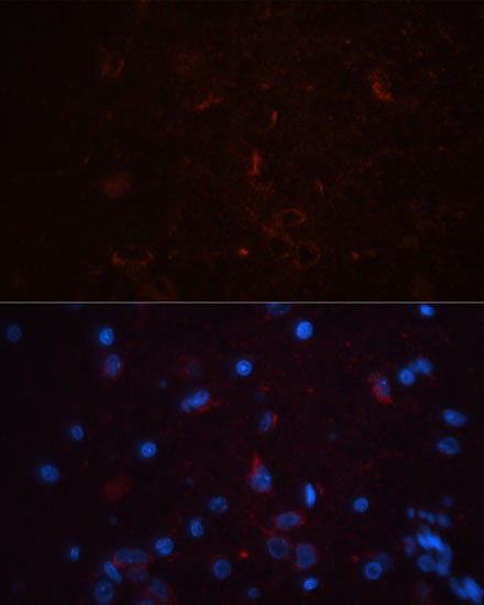 Immunofluorescence - THY1 Polyclonal Antibody 