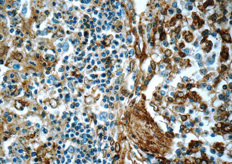 Immunohistochemistry of paraffin-embedded human spleen tissue slide using Catalog No:108096(ANXA5 Antibody) at dilution of 1:400 (under 40x lens)