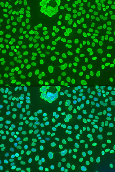 Immunofluorescence - OCT4 Polyclonal Antibody 