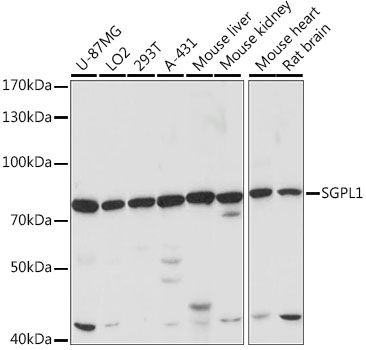 Western blot - SGPL1 Polyclonal Antibody 