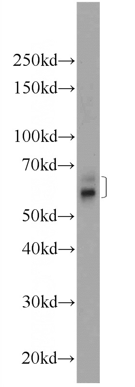 mouse embryo tissue were subjected to SDS PAGE followed by western blot with Catalog No:115846(KIAA0586 Antibody) at dilution of 1:600
