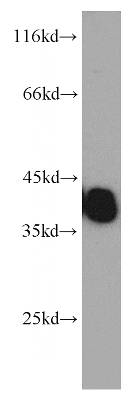 mouse skeletal muscle tissue were subjected to SDS PAGE followed by western blot with Catalog No:116206(TPM3 antibody) at dilution of 1:800