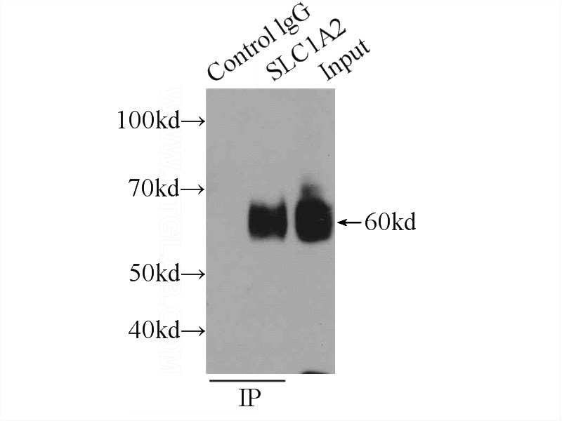 IP Result of anti-SLC1A2 (IP:Catalog No:110158, 3ug; Detection:Catalog No:110158 1:1000) with mouse brain tissue lysate 6000ug.