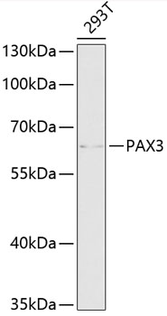 Western blot - PAX3 Polyclonal Antibody 