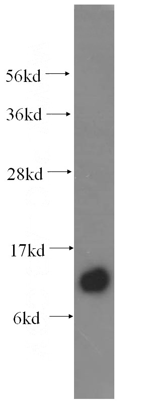 human skin tissue were subjected to SDS PAGE followed by western blot with Catalog No:115558(SPCS1 antibody) at dilution of 1:400