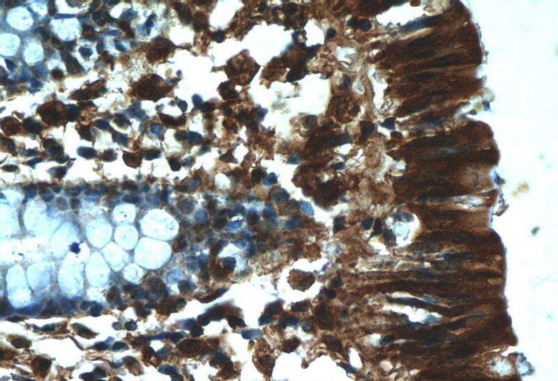 Immunohistochemistry of paraffin-embedded human colon tissue slide using Catalog No:114723(RMND5B Antibody) at dilution of 1:50 (under 40x lens)