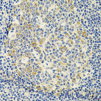 Immunohistochemistry - DDX20 Polyclonal Antibody 