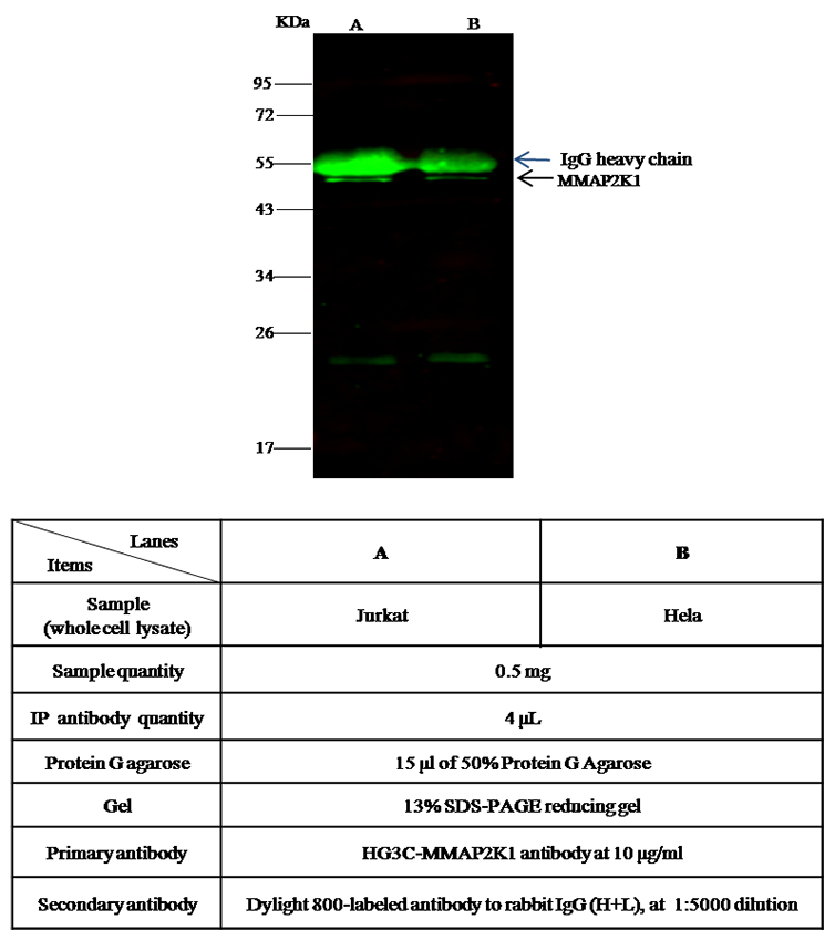 Mouse MEK1/MAP2K1/MKK1 Immunoprecipitation(IP) 15753
