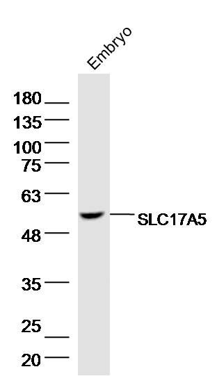Fig1: Sample: Embryo (Mouse) Lysate at 40 ug; Primary: Anti-SLC17A5 at 1/300 dilution; Secondary: IRDye800CW Goat Anti-Rabbit IgG at 1/20000 dilution; Predicted band size: 129 kD; Observed band size: 129 kD