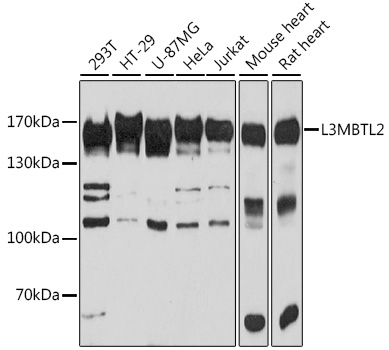 Western blot - LNPEP Polyclonal Antibody 