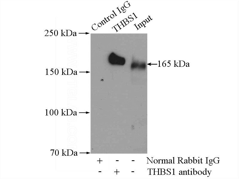 IP Result of anti-TSP1 (IP:Catalog No:116056, 4ug; Detection:Catalog No:116056 1:500) with HeLa cells lysate 2000ug.