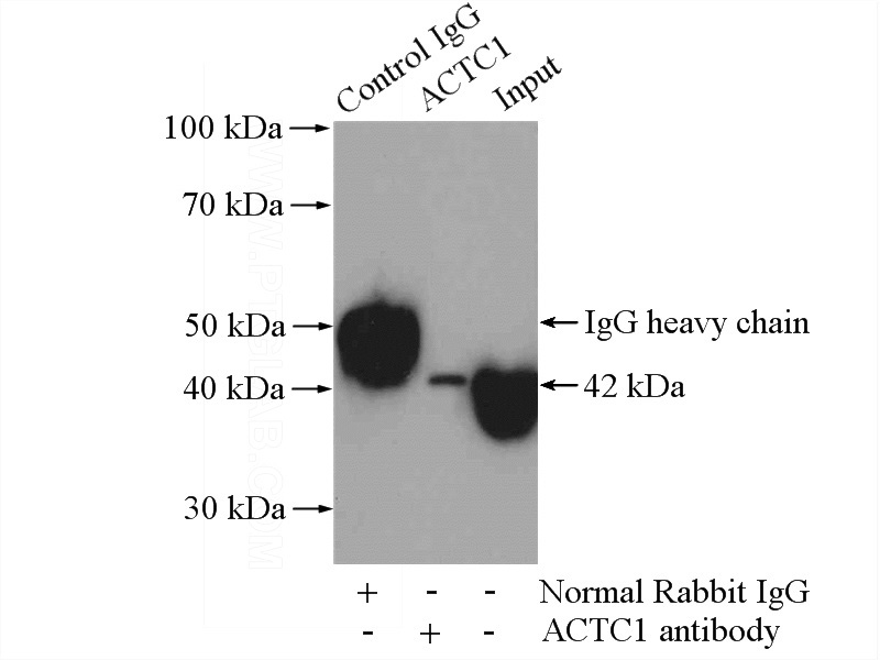 IP Result of anti-ACTC1 (IP:Catalog No:107863, 4ug; Detection:Catalog No:107863 1:800) with mouse heart tissue lysate 3200ug.