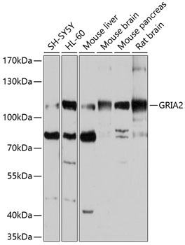 Western blot - GRIA2 Polyclonal Antibody 