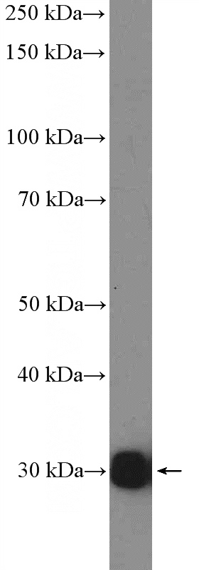 mouse liver tissue were subjected to SDS PAGE followed by western blot with Catalog No:113258(NNMT Antibody) at dilution of 1:600