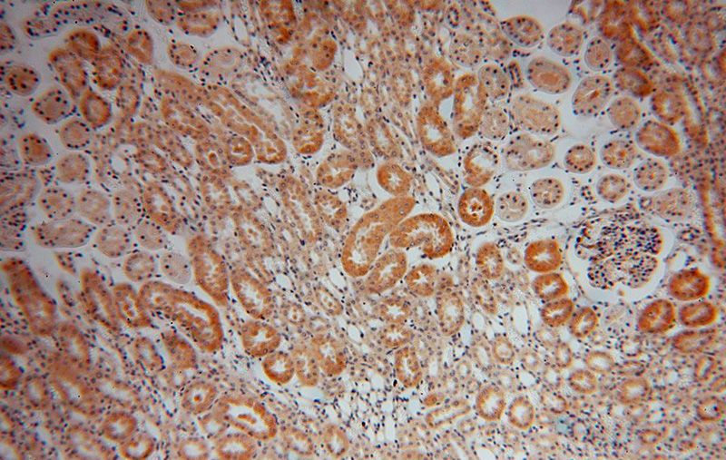 Immunohistochemical of paraffin-embedded human kidney using Catalog No:109328(CKAP4 antibody) at dilution of 1:200 (under 10x lens)