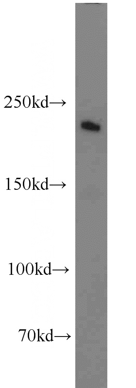 mouse brain tissue were subjected to SDS PAGE followed by western blot with Catalog No:114773(ROBO1-Specific antibody) at dilution of 1:1000