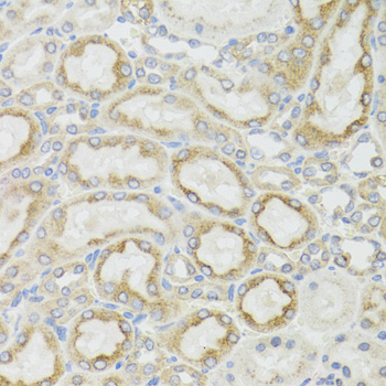 Immunohistochemistry - MT-ND5 Polyclonal Antibody 