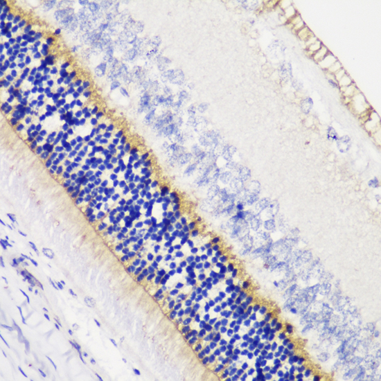 Immunohistochemistry - ANO2 Polyclonal Antibody 