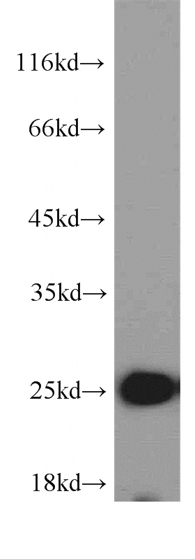 L02 cells were subjected to SDS PAGE followed by western blot with Catalog No:114385(PSMB5 antibody) at dilution of 1:1000