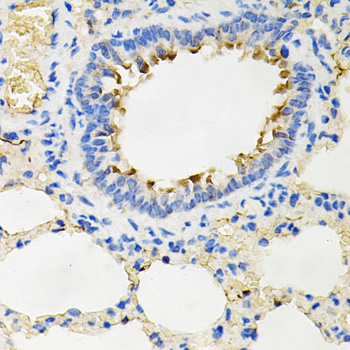 Immunohistochemistry - IRAK2 Polyclonal Antibody 