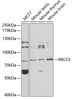 Western blot - ERCC3 Polyclonal Antibody 