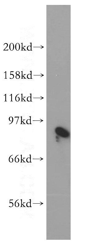 Jurkat cells were subjected to SDS PAGE followed by western blot with Catalog No:117147(BIN2 antibody) at dilution of 1:400
