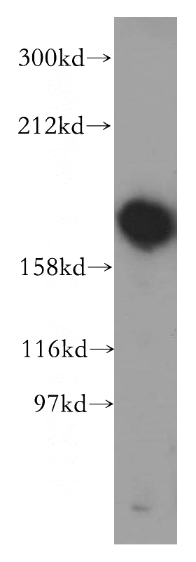 mouse brain tissue were subjected to SDS PAGE followed by western blot with Catalog No:116554(UGCGL1 antibody) at dilution of 1:500