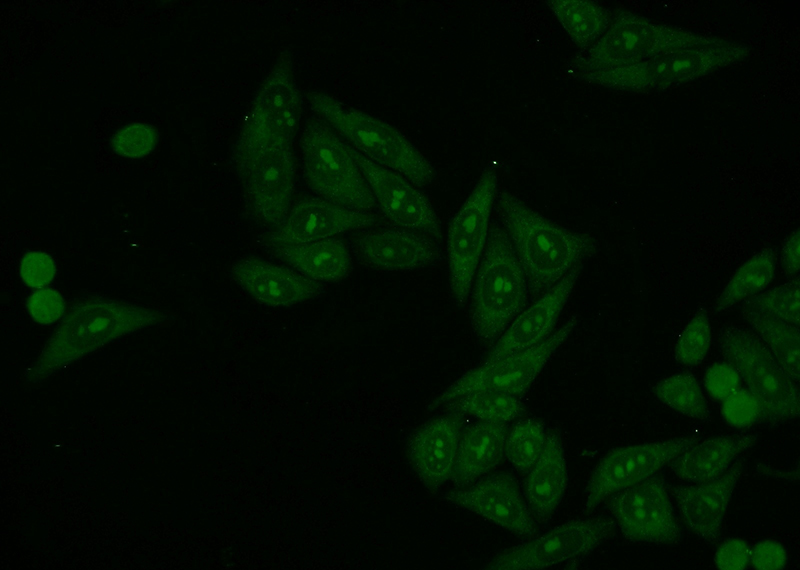 Immunofluorescent analysis of HepG2 cells using Catalog No:112151(LAS1L Antibody) at dilution of 1:50 and Alexa Fluor 488-congugated AffiniPure Goat Anti-Rabbit IgG(H+L)