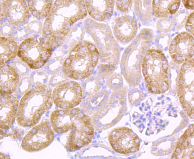 Fig5:; Immunohistochemical analysis of paraffin-embedded mouse kidney tissue using anti-Urokinase antibody. The section was pre-treated using heat mediated antigen retrieval with Tris-EDTA buffer (pH 8.0-8.4) for 20 minutes.The tissues were blocked in 5% BSA for 30 minutes at room temperature, washed with ddH; 2; O and PBS, and then probed with the primary antibody ( 1/50) for 30 minutes at room temperature. The detection was performed using an HRP conjugated compact polymer system. DAB was used as the chromogen. Tissues were counterstained with hematoxylin and mounted with DPX.