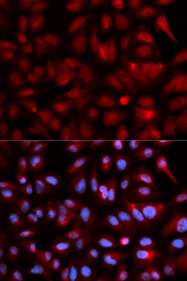Immunofluorescence - PSMB5 Polyclonal Antibody 