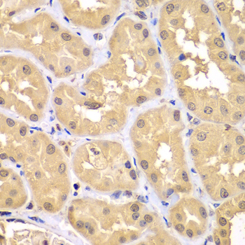 Immunohistochemistry - TRIM69 Polyclonal Antibody 