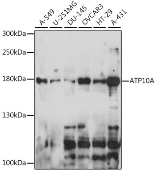 Western blot - ATP10A Polyclonal Antibody 