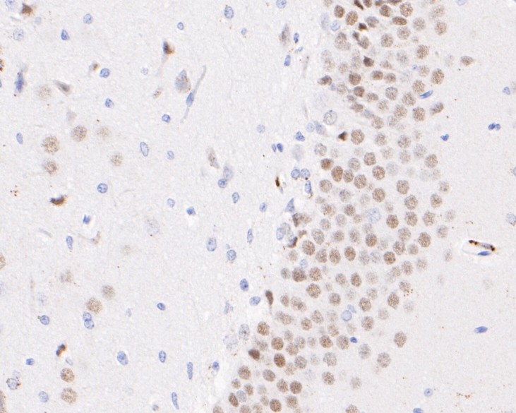 Fig1: Immunohistochemical analysis of paraffin-embedded rat brain tissue using anti-NeuroD2 antibody. The section was pre-treated using heat mediated antigen retrieval with sodium citrate buffer (pH 6.0) for 20 minutes. The tissues were blocked in 5% BSA for 30 minutes at room temperature, washed with ddH2O and PBS, and then probed with the primary antibody ( 1/50) for 30 minutes at room temperature. The detection was performed using an HRP conjugated compact polymer system. DAB was used as the chromogen. Tissues were counterstained with hematoxylin and mounted with DPX.