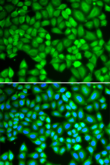 Immunofluorescence - WAS Polyclonal Antibody 