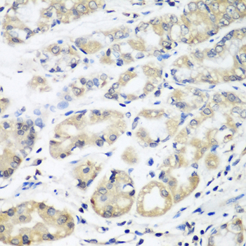 Immunohistochemistry - HLA-DMB Polyclonal Antibody 