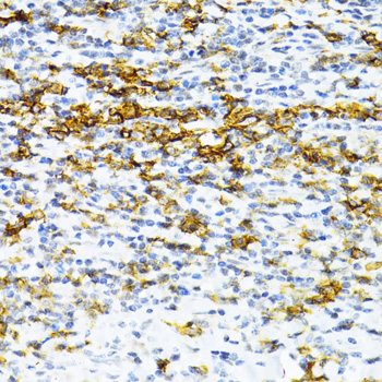 Immunohistochemistry - SNRNP70 Polyclonal Antibody 